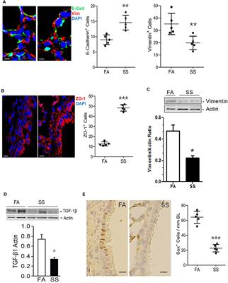 Gestational Exposure to Cigarette Smoke Suppresses the Gasotransmitter H2S Biogenesis and the Effects Are Transmitted Transgenerationally